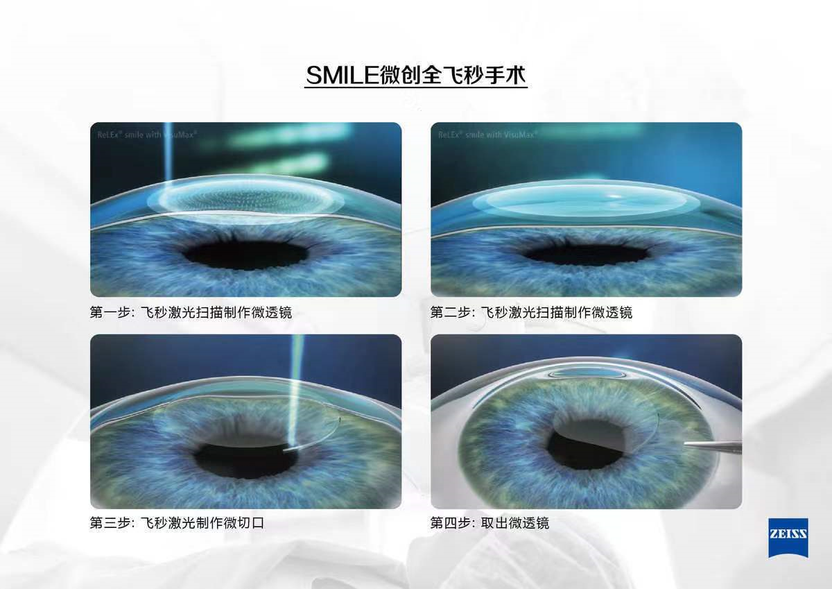 64a270f1526b7.png 3.png